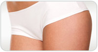 Liposuction
